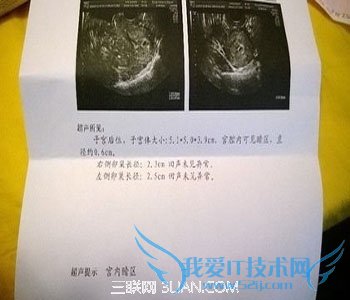 ����40������С��Σ��          52IJĸӤ����