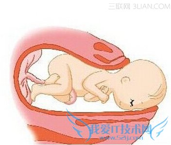 胎盘位于子宫前壁是男孩还是女孩 52IJ母婴教育