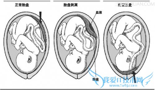 ǰ��̥���м������          52IJĸӤ����