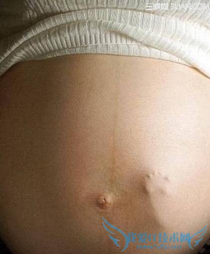 胎动什么时候开始出现? 52IJ母婴教育