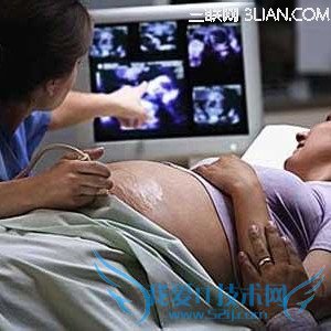 b̥Ӱ          52IJĸӤ