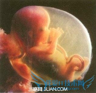 产妇胎儿双亡“杀手”是羊水 52IJ母婴教育