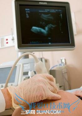 准妈妈应该做几次B超 52IJ母婴教育