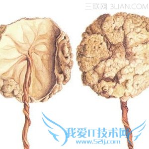 胎盘怎么形成的 52IJ母婴教育