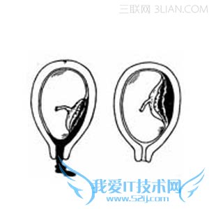 ̥ʲô˼         52IJĸӤ