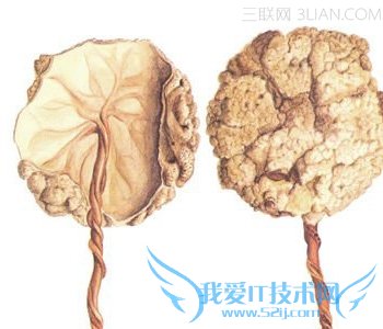 吃胎盘是什么 52IJ母婴教育