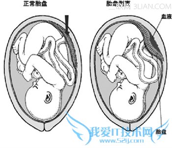 ֲ̥Ԥʩ           52IJĸӤ