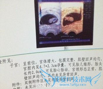 孕囊大小对照表 52IJ母婴教育