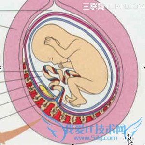 胎盘的成熟度 52IJ母婴教育