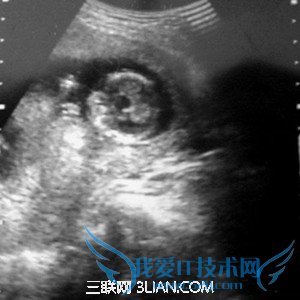 怀孕多久可以做b超? 52IJ母婴教育