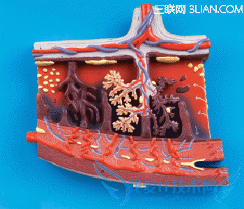 胎盘厚度过厚怎么办 52IJ母婴教育