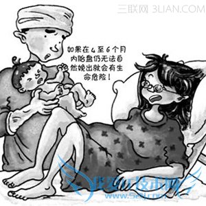 胎盘滞留是什么 52IJ母婴教育