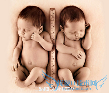 重型地中海贫血的症状 52IJ母婴教育