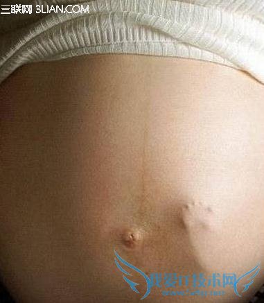 怀孕多久开始胎动? 52IJ母婴教育