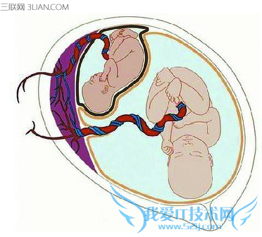 ˫̥Щ֢״   52IJĸӤ