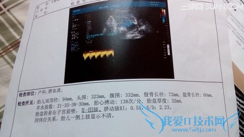 ̥صĳ            52IJĸӤ