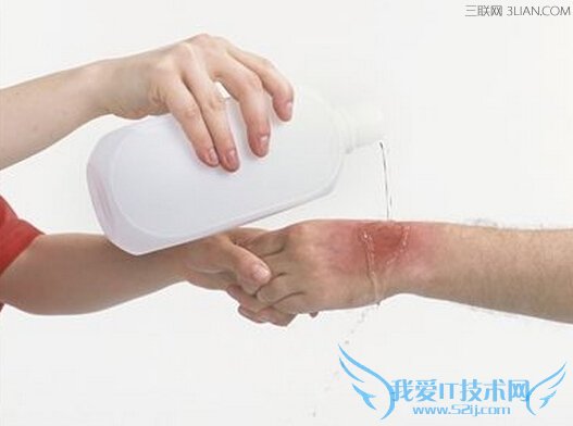 8种常见急救法 52IJ