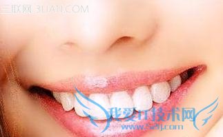 5类食物坚固牙齿 52IJ