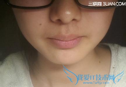 ×ì´½·¢°×¾¯ÌèÏû»¯ÏµÍ³¼²²¡ 52IJ