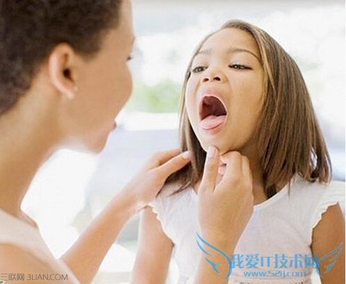 孩子鱼刺卡喉怎么办 52IJ