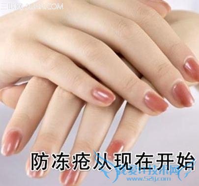 冬天如何防止生冻疮 52IJ