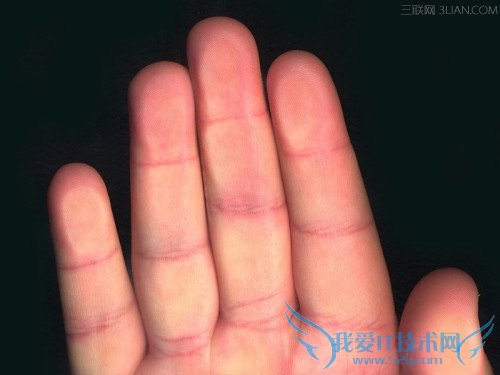 为什么人类的手指泡了水后会皱? 52IJ