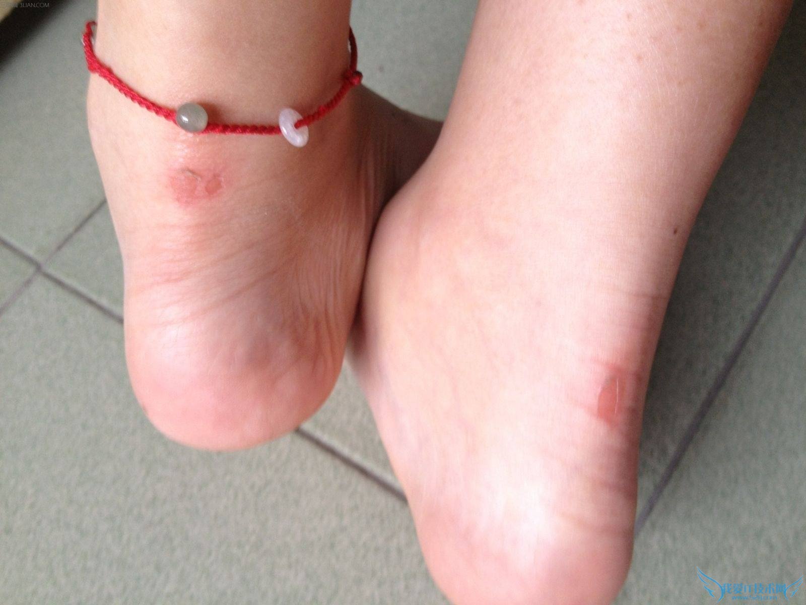 鞋子磨脚怎么办 52IJ