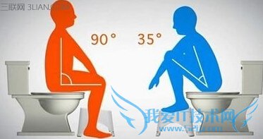 坐马桶时怎样的姿势更利于排便 52IJ
