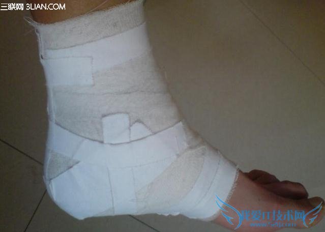 遭遇崴脚的解决之道 52IJ