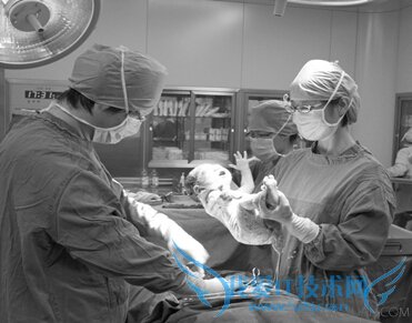 哪些情况必须选择剖腹产 52IJ母婴教育