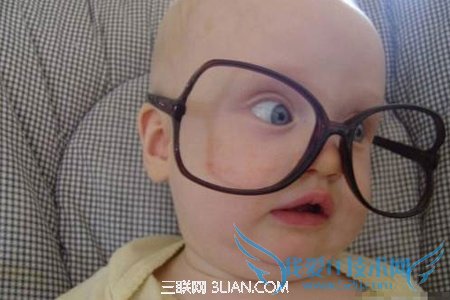 如何预防婴儿斗鸡眼 52IJ母婴教育