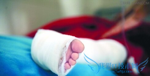 宝宝扭伤怎么办 52IJ母婴教育