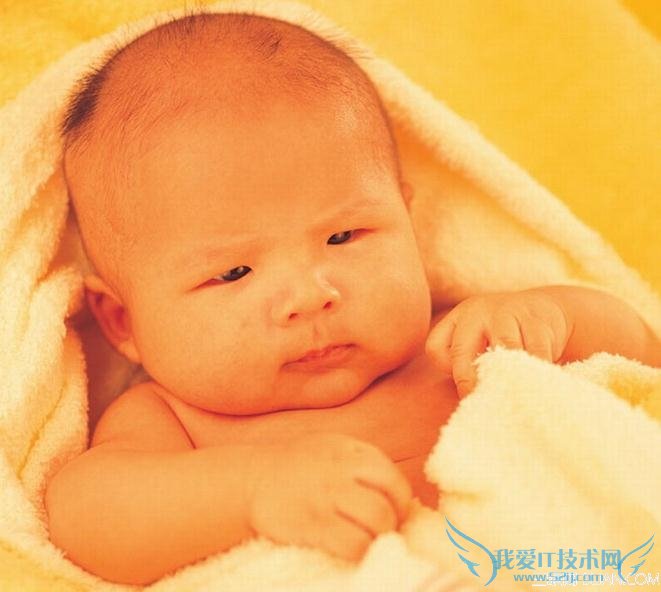 照顾新生儿黄疸的常识有哪些? 三联