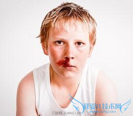 小孩流鼻血是怎么回事 52IJ母婴教育