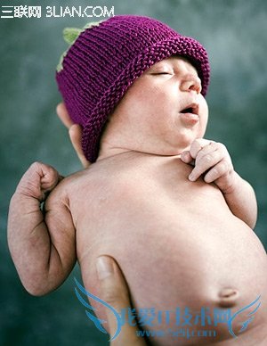 怎么清洗新生儿肚脐 52IJ母婴教育