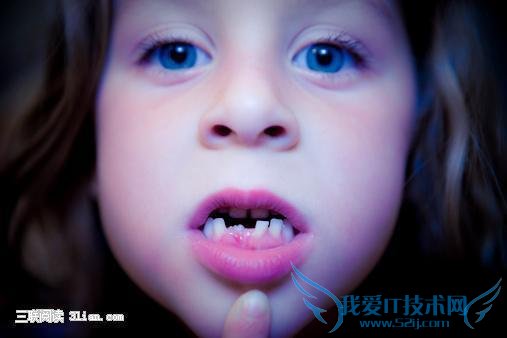 宝宝断奶太晚易产生龋齿 52IJ母婴教育