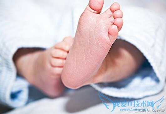 “夏季热”怎么治疗 52IJ母婴教育