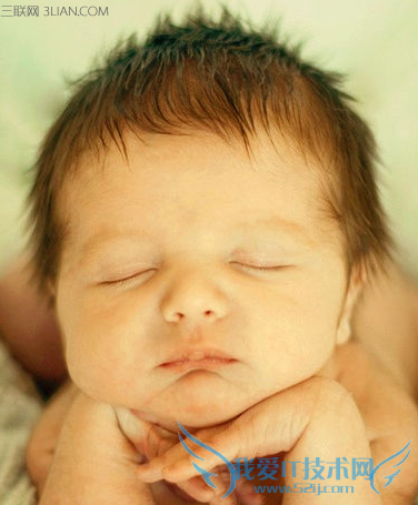 新生儿黄疸是什么原因 三联