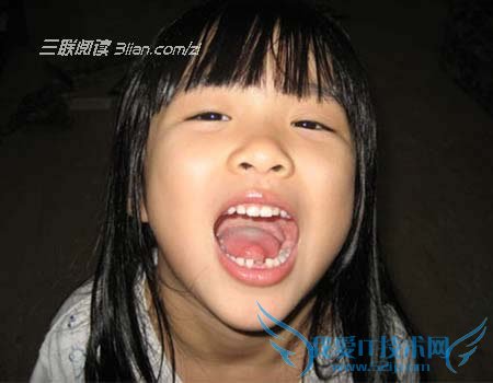 宝宝护牙必须知道的常识 52IJ母婴教育阅读