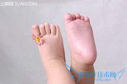 宝宝夏天光脚丫不妥 52IJ母婴教育