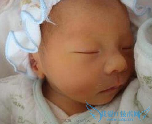 如何预防新生儿脸色发黄 52IJ母婴教育