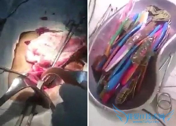 ҽӲ˶ȡ18ˢôԽȥģ