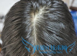 25岁之后保养皮肤的秘诀