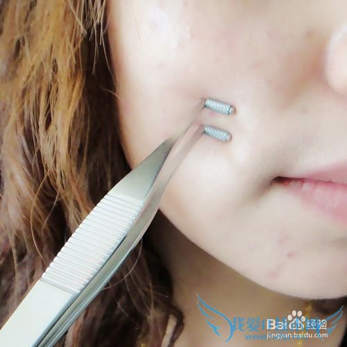 火山泥的功效作用/火山泥能祛痘祛黑头吗