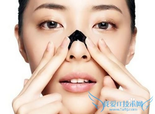 火山泥的功效作用/火山泥能祛痘祛黑头吗