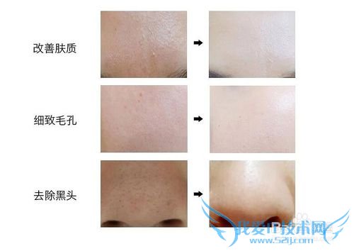 洗澡你真的洗干净了吗?怎么洗澡才干净