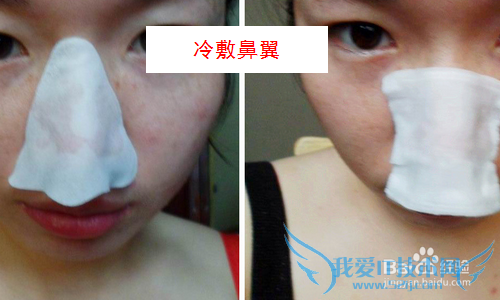 春夏之际如何预防流鼻血?流鼻血怎么快速止血?